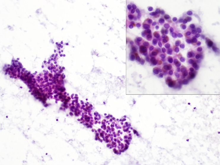 Fig. 2