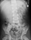 Fig. 4