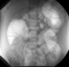 Fig. 5