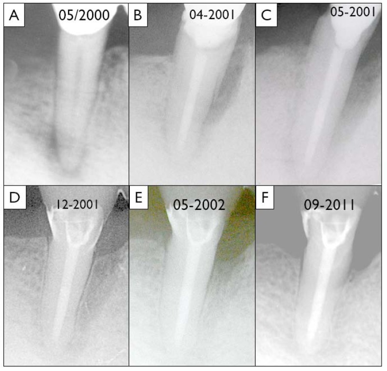 Fig. (1)