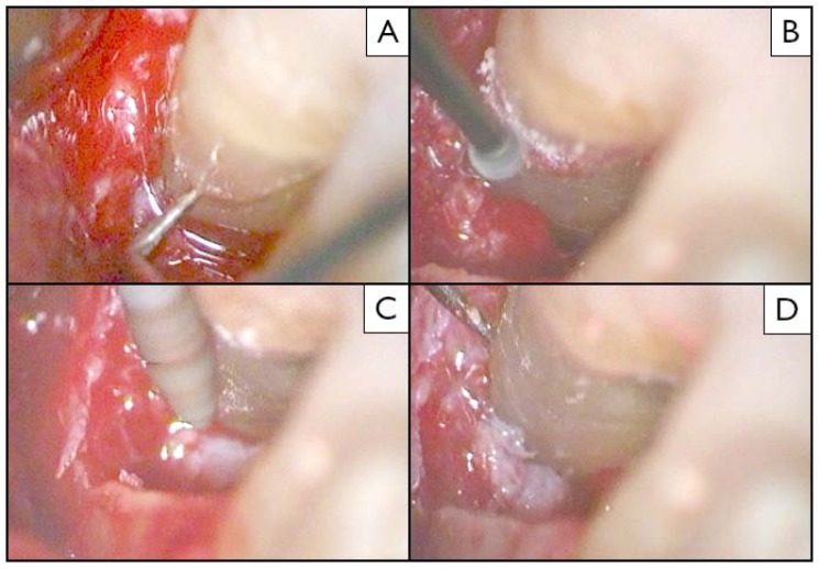 Fig. (2)