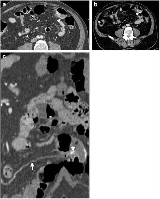 Fig. 9