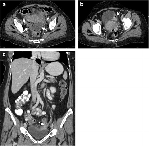 Fig. 10