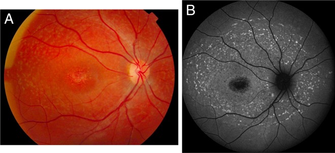 Figure 1