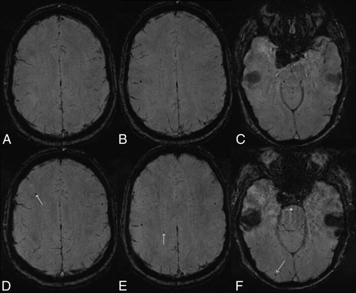 Fig 3.