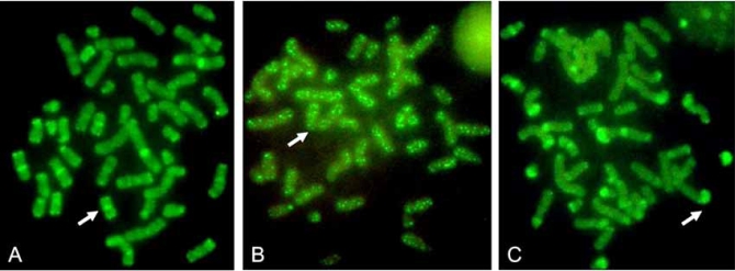 Fig. (1)