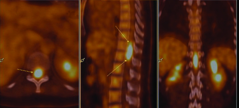 Figure 2. 