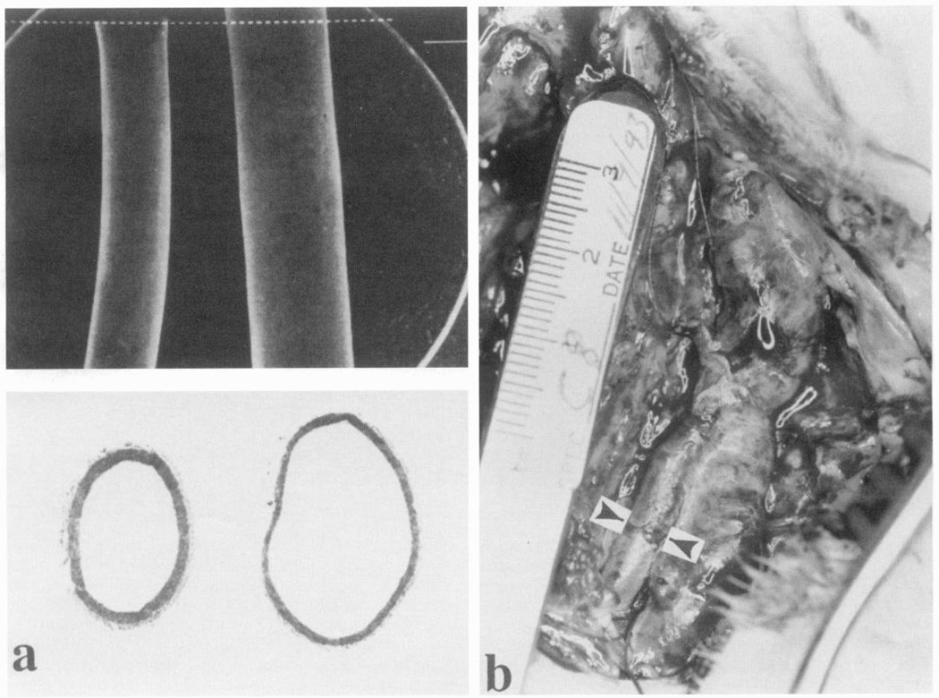 FIG. 14