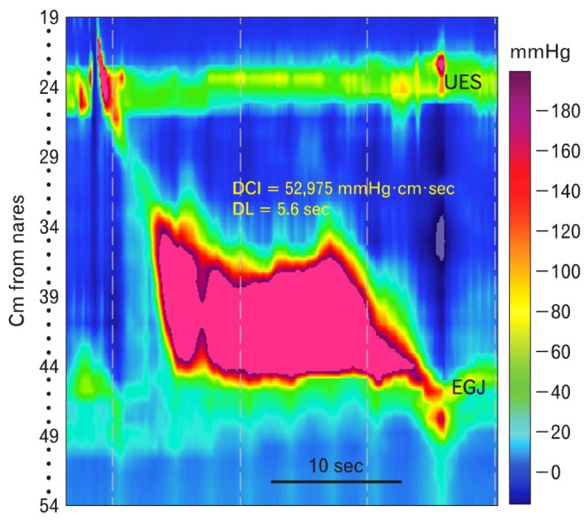 Figure 11