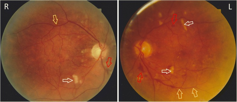 Fig. 2