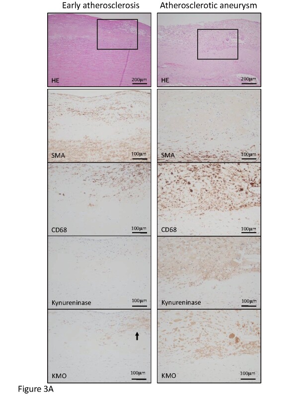 Fig.3. Representative histological and immunohistochemical images for cells and kynurenine pathway enzymes in the early atherosclerotic lesion and atherosclerotic aneurysm