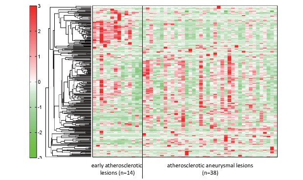 Fig.2. Metabolomic analysis of early atherosclerotic lesions and atherosclerotic aneurysms.