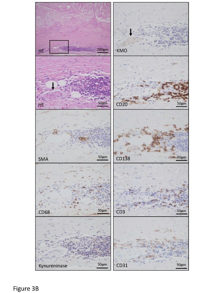 Fig.3. Representative histological and immunohistochemical images for cells and kynurenine pathway enzymes in the early atherosclerotic lesion and atherosclerotic aneurysm