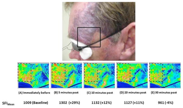 Fig. 7