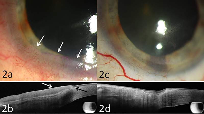 Figure 2: