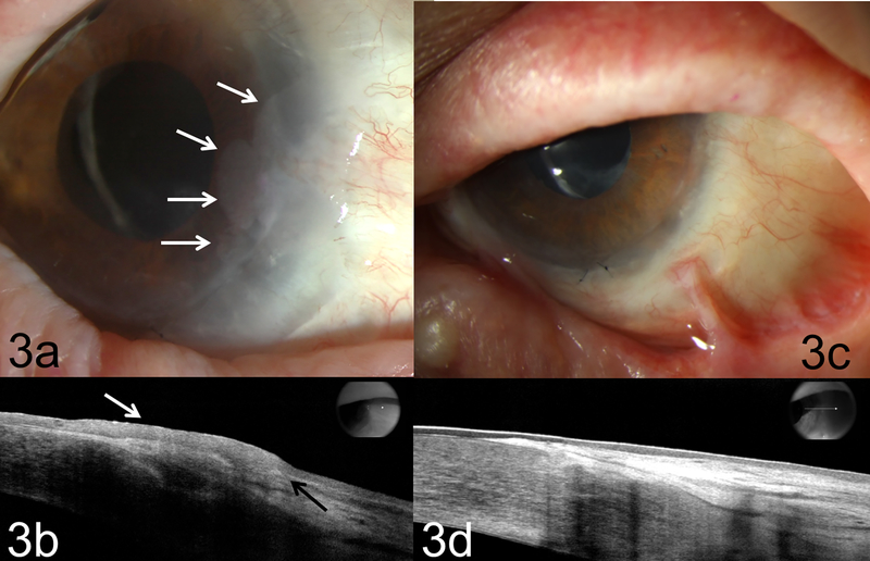 Figure 3: