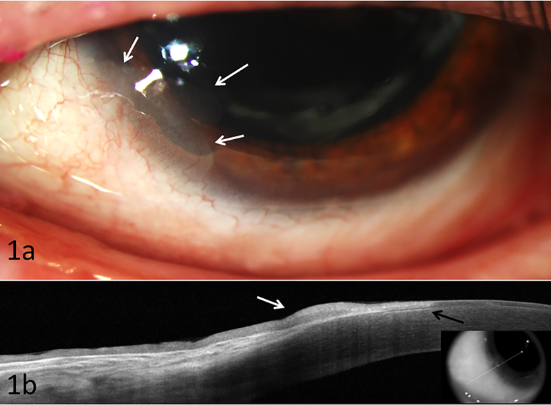 Figure 1: