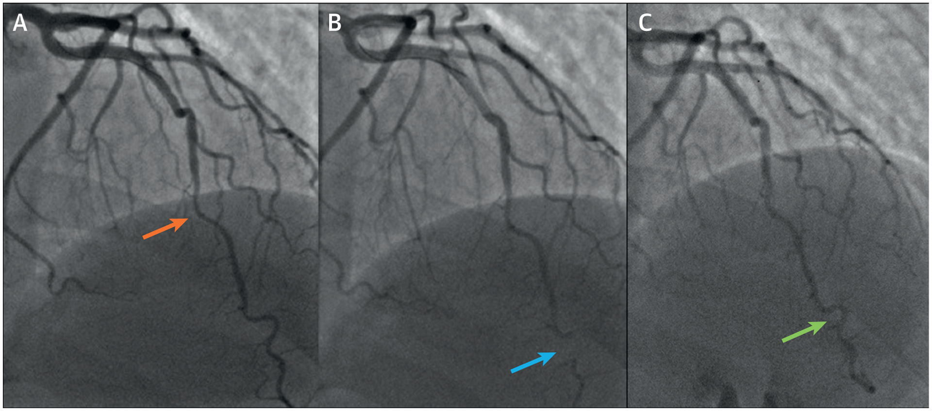 FIGURE 6