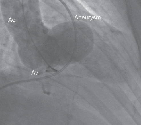 Figure 2)