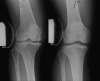 Fig. 1a, b