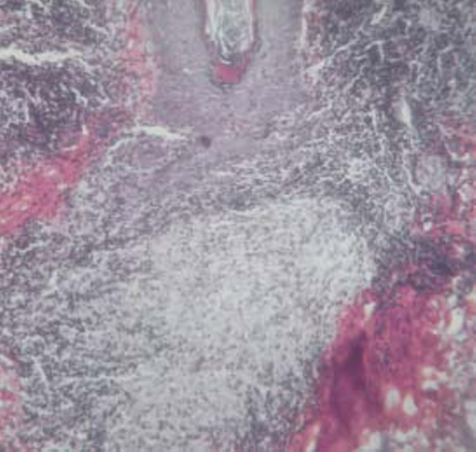 Fig 3