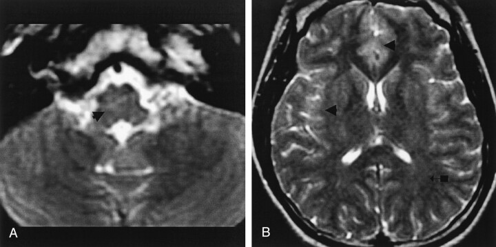 Fig 2.