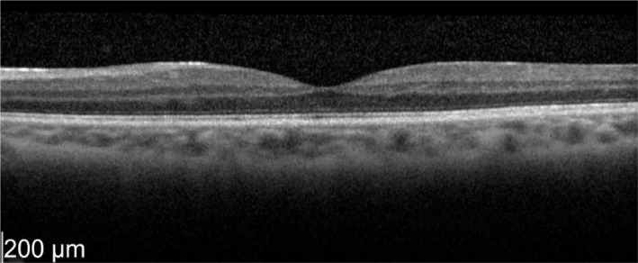 Figure 14