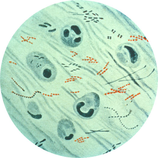 Researchers deduced the mechanism of the highly conserved sulfonucleotide reductase enzyme in Mycobacterium tuberculosis pictured here (Image: US Centers for Disease Control and Prevention)