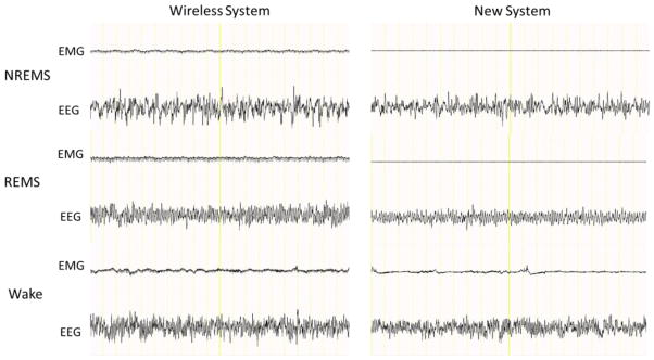 Fig 3