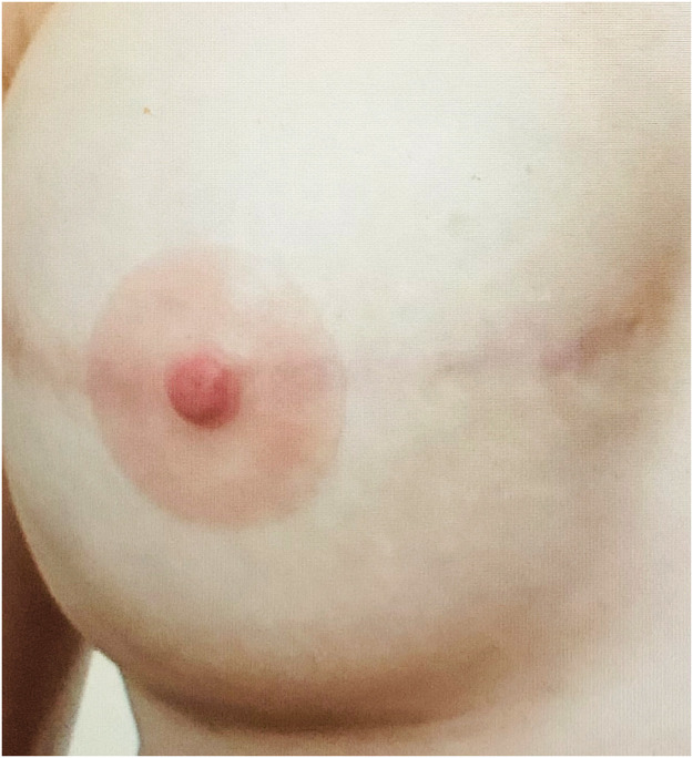 Fig 5