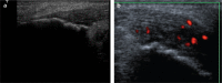 Figure 3. a, b.