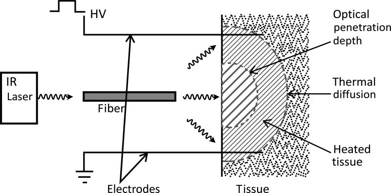 Fig. (1)