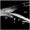 Fig. 14