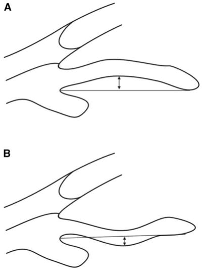 Fig. 16