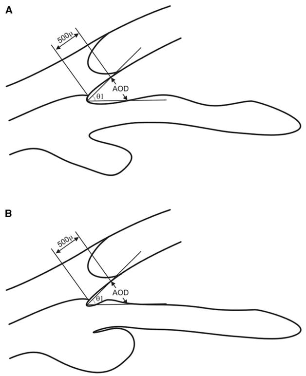 Fig. 17