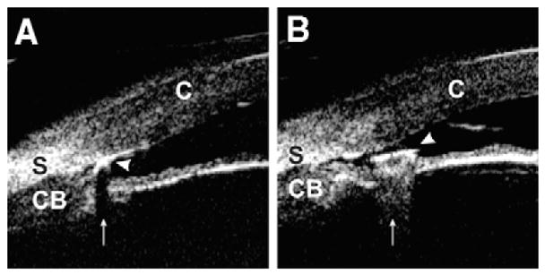 Fig. 12