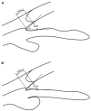 Fig. 17