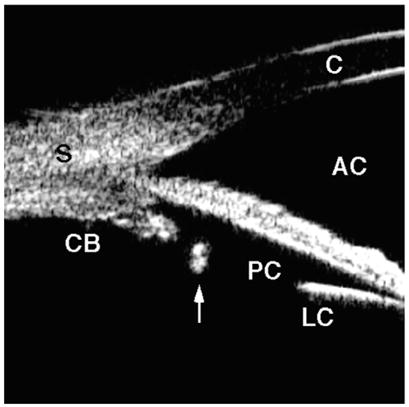 Fig. 14