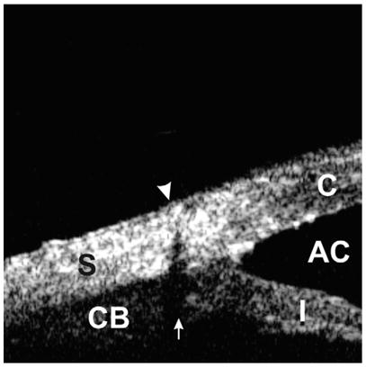 Fig. 13