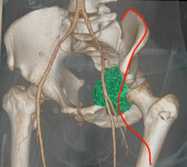 Fig. 2