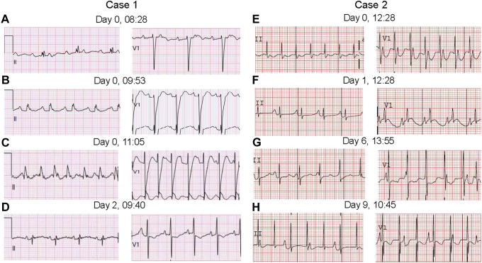 Figure 2