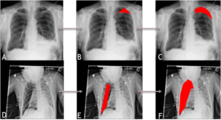 Fig. 5