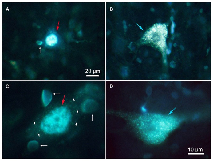 FIGURE 3