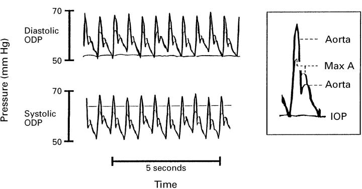 Figure 1  