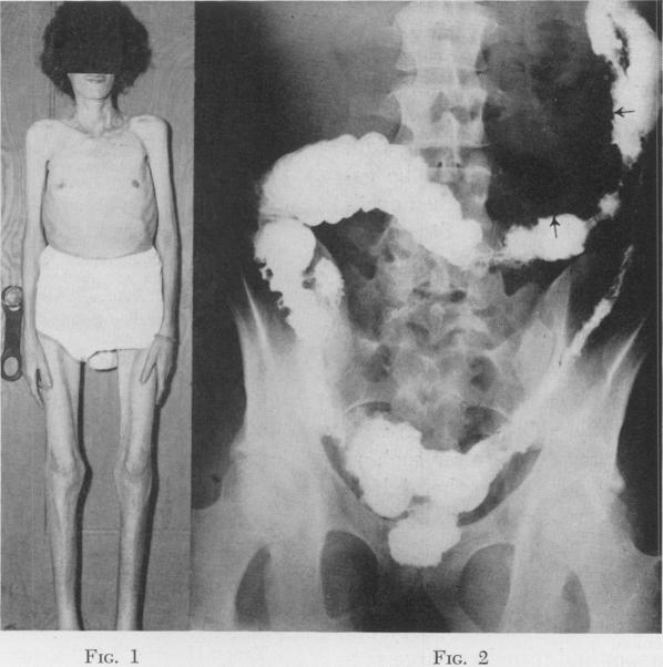 Fig. 1., Fig. 2.