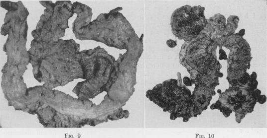 Fig. 9., Fig. 10.