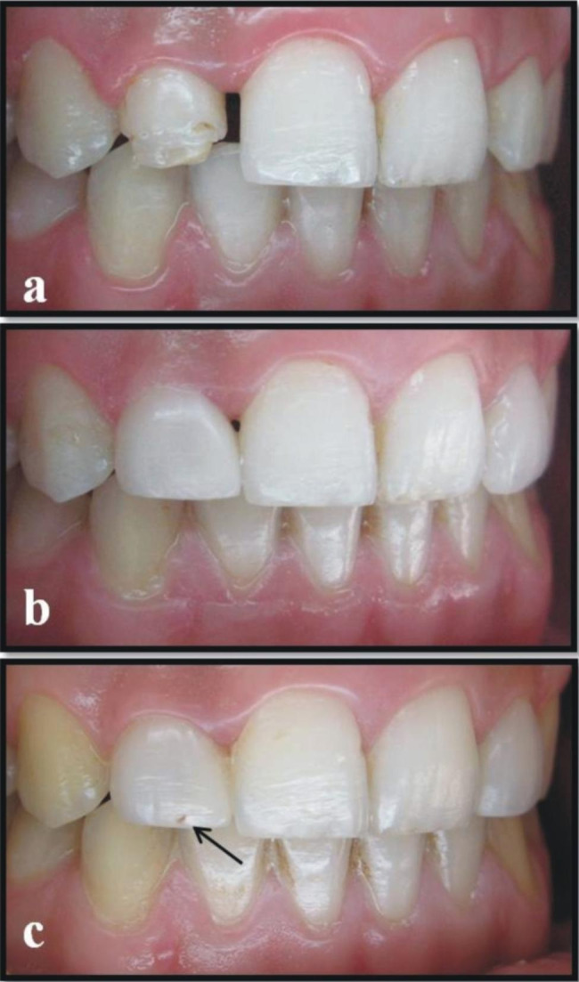 Fig. 6