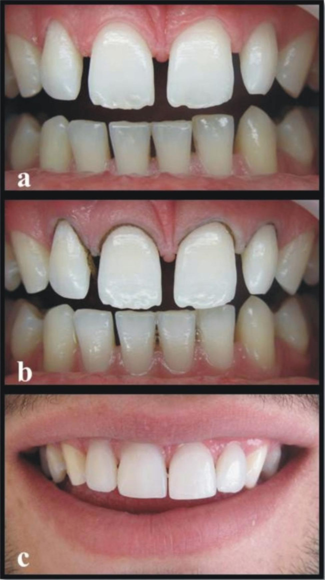 Fig. 1