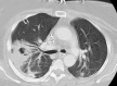Figure 28-1