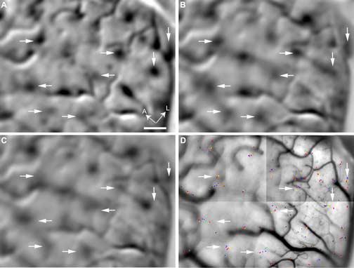 Fig. 11